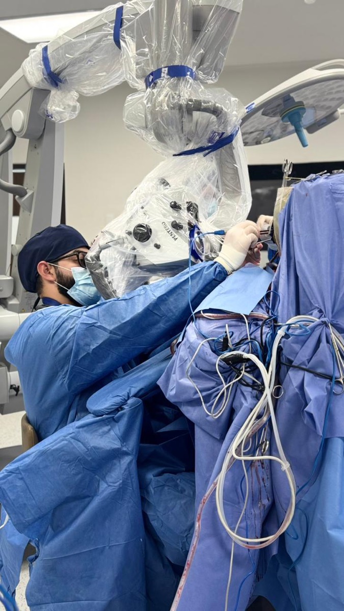 Cirugía de tumor cerebral asistida por microscopio quirúrgico